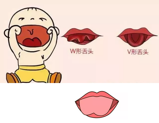 03.png